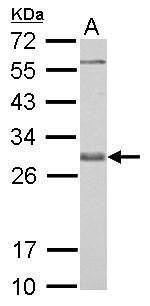 Bcl-X antibody