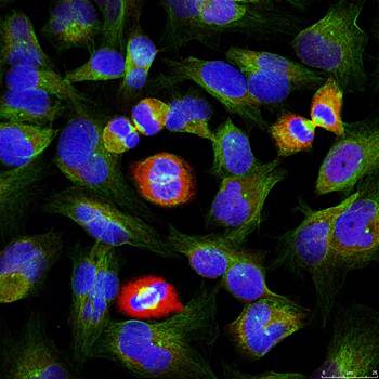 BCL-XL (Phospho-Ser62) Antibody