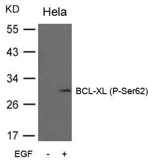BCL-XL (Phospho-Ser62) Antibody