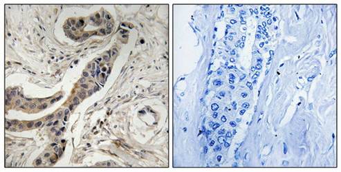 BCL-XL (Phospho-Thr115) Antibody