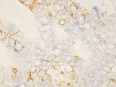 Bcl-XS/BCL2L1 Antibody
