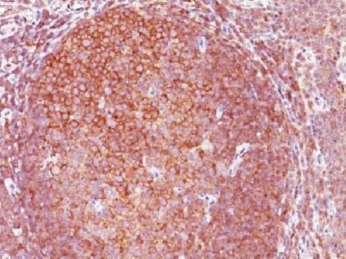 BCL10 (MALT-Lymphoma Marker) Antibody