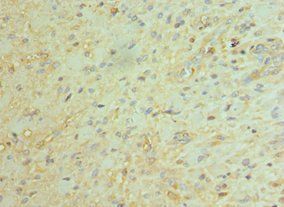 BCL11A Antibody