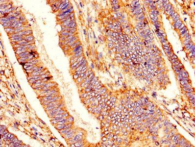 BCL2L1 Antibody
