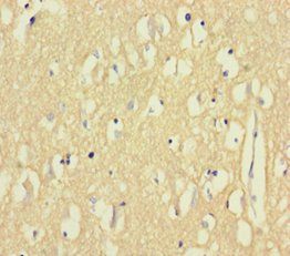 BCL2L2 Antibody