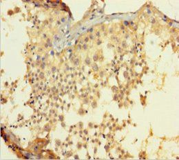 BCL2L2 Antibody