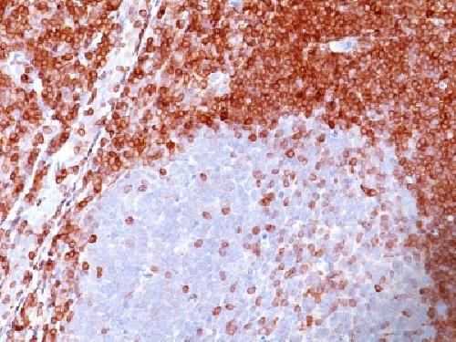 Bcl-2 (Apoptosis & Follicular Lymphoma Marker) Antibody