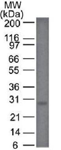 Bcl-2 (Apoptosis & Follicular Lymphoma Marker) Antibody