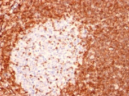 Bcl-2 (Apoptosis & Follicular Lymphoma Marker) Antibody
