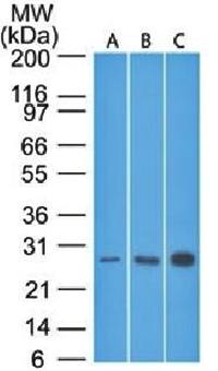 Bcl-2 (Apoptosis & Follicular Lymphoma Marker) Antibody
