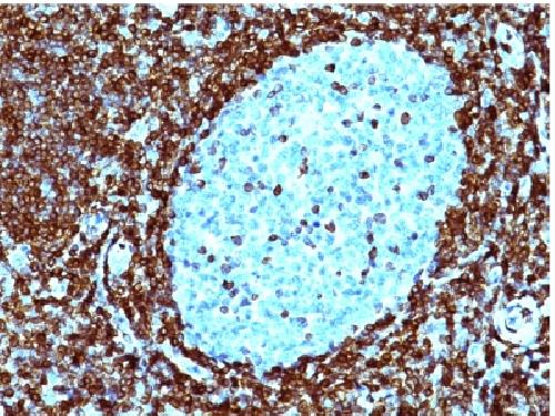 Bcl-2 (Apoptosis & Follicular Lymphoma Marker) Antibody