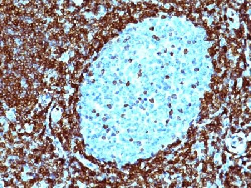 Bcl-2 (Apoptosis & Follicular Lymphoma Marker) Antibody