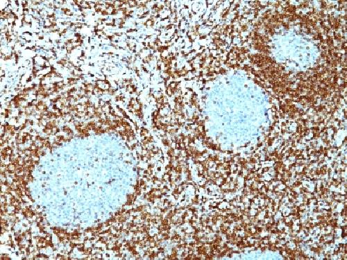 Bcl-2 (Apoptosis & Follicular Lymphoma Marker) Antibody