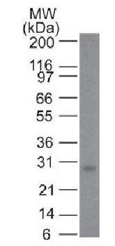 Bcl-2 (Apoptosis & Follicular Lymphoma Marker) Antibody