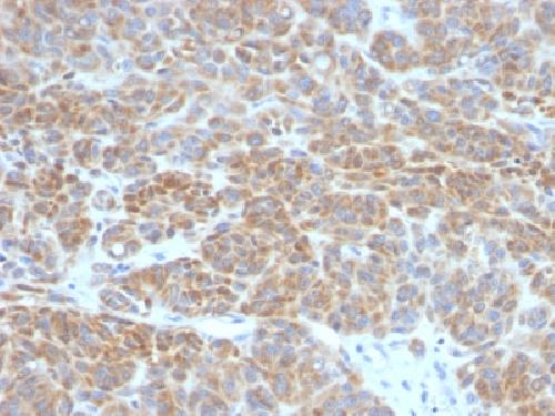 Bcl-2 (Apoptosis & Follicular Lymphoma Marker) Antibody
