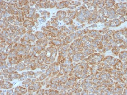 Bcl-2 (Apoptosis & Follicular Lymphoma Marker) Antibody