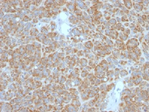 Bcl-2 (Apoptosis & Follicular Lymphoma Marker) Antibody