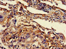BCL2 Antibody