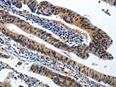 BCL2 Antibody
