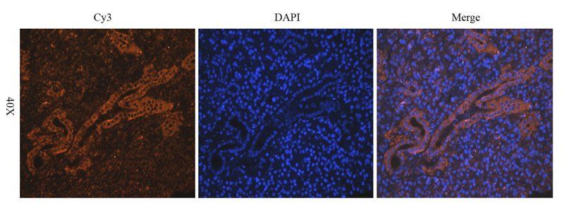 BCL2 antibody