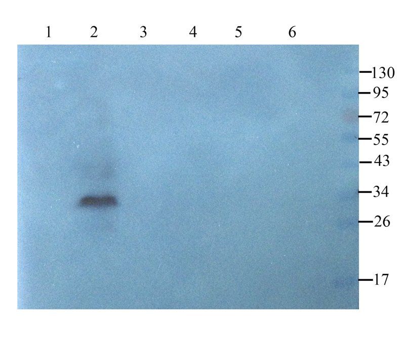 BCL2 antibody