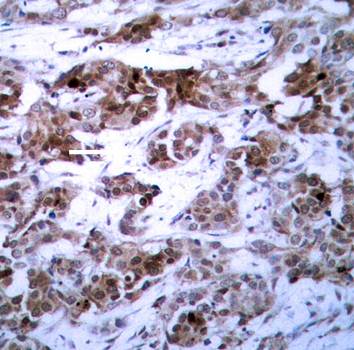 BCL-2 (Ab-70) Antibody