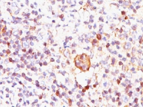 Bcl-X (Apoptosis Marker) Antibody