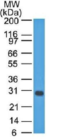 Bcl-X (Apoptosis Marker) Antibody