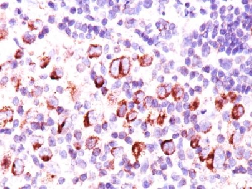 Bcl-X (Apoptosis Marker) Antibody