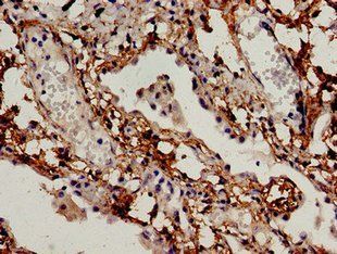 BCL2L11 antibody