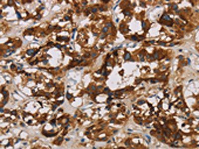 BCL2L12 antibody