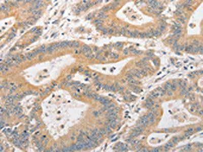 BCL2L14 Antibody