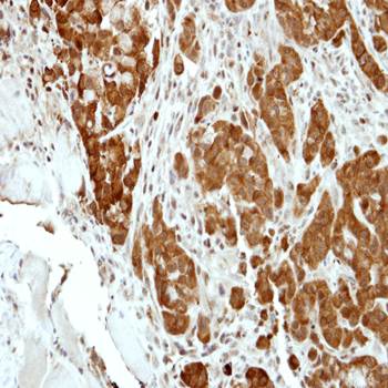 BCL2L15 antibody