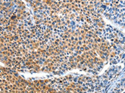 BCL2L2 Antibody