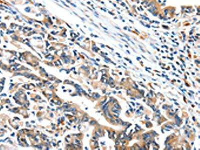 BCL2L2 Antibody