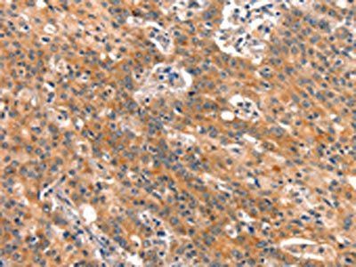 BCL3 Antibody