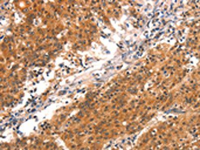 BCL3 Antibody