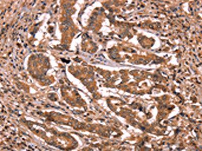 BCL6 Antibody