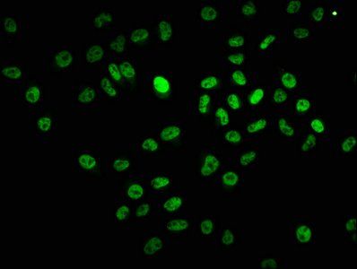 BCL9 Antibody