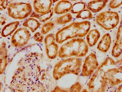 BCL9 Antibody