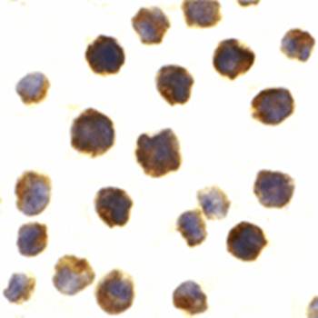 Bcl-2 Antibody