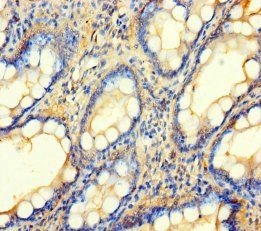 BCO1 Antibody