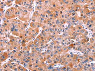 BCR Antibody