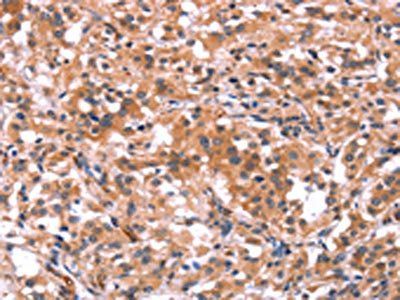 BCR Antibody
