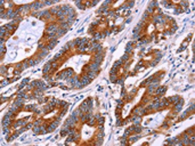 BCR Antibody