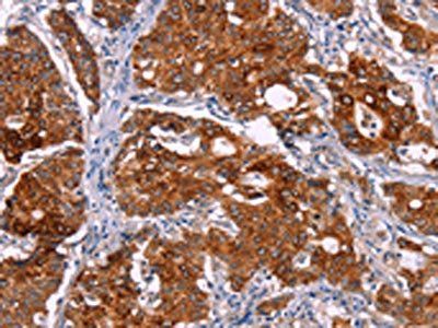 BCR Antibody