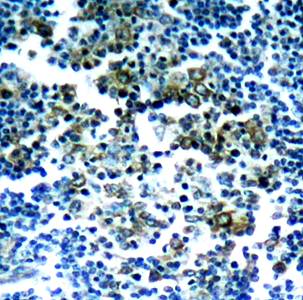 Bcr (Phospho-Tyr177) Antibody
