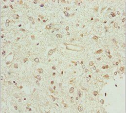 BCS1L antibody