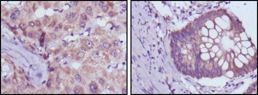 BDH1 Antibody