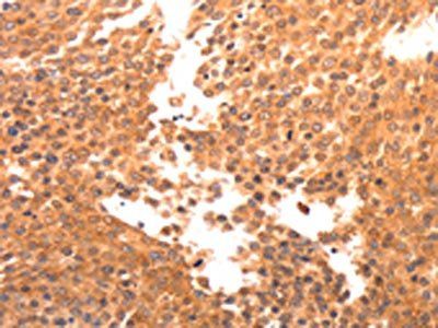 BDKRB2 antibody